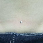 back-dermal-300x292