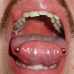 Horizontal-tongue-piercing