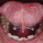 Horizontal-tongue-piercing-webbing