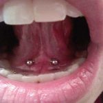 Tongue-piercing-frenulum